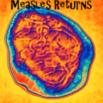 measles vaccinations