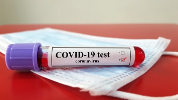 COVID-19 testing options